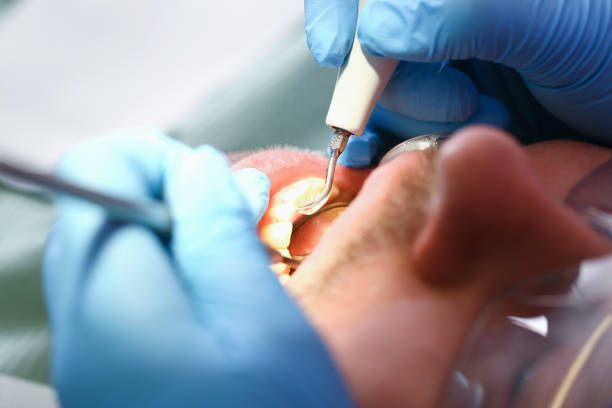 Best Mobile Emergency Dentist in Lynnwood, WA