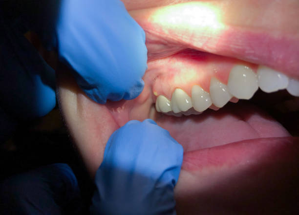 Best Emergency Dentist for Special Needs Patients in Lynnwood, WA